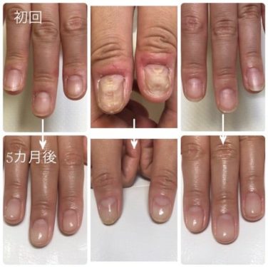 02-1トラブルなし・デコボコ　育成前・結果